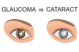 Glaucoma vs. cataracts: Understanding the difference